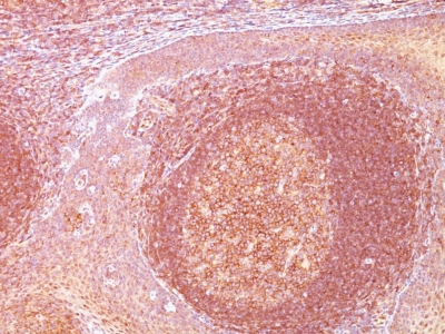Formalin-fixed, paraffin-embedded human Tonsil stained with BCL1 Monoclonal Antibody (SPM52).