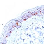 Formalin-fixed, paraffin-embedded human Skin stained with CD1a Monoclonal Antibody (O1).