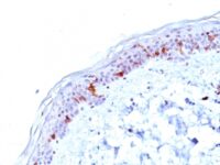 Formalin-fixed, paraffin-embedded human Skin stained with CD1a Monoclonal Antibody (O1).