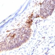 Formalin-fixed, paraffin-embedded human Skin stained with CD1a Monoclonal Antibody (SPM12).