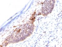 Formalin-fixed, paraffin-embedded human Skin stained with CD1a Monoclonal Antibody (SPM12).