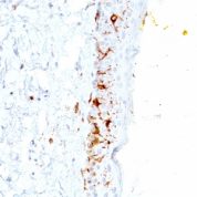 Formalin-fixed, paraffin-embedded human Skin stained with CD1a Monoclonal Antibody (C1A/711).
