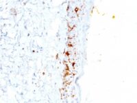 Formalin-fixed, paraffin-embedded human Skin stained with CD1a Monoclonal Antibody (C1A/711).