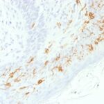 Formalin-fixed, paraffin-embedded human Skin stained with CD1a Recombinant Rabbit Monoclonal Antibody (C1A/156R).