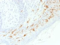 Formalin-fixed, paraffin-embedded human Skin stained with CD1a Recombinant Rabbit Monoclonal Antibody (C1A/156R).