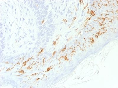Formalin-fixed, paraffin-embedded human Skin stained with CD1a Recombinant Rabbit Monoclonal Antibody (C1A/156R).