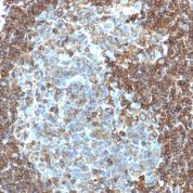 Formalin-fixed, paraffin-embedded human Tonsil stained with CD3 epsilon Monoclonal Antibody (PC3/188A).