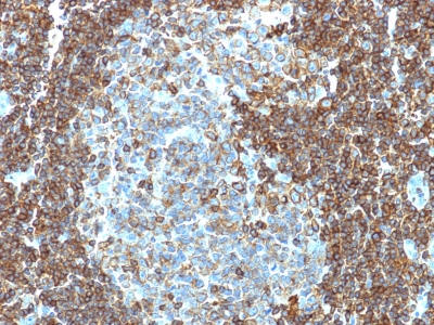 Formalin-fixed, paraffin-embedded human Tonsil stained with CD3 epsilon Monoclonal Antibody (PC3/188A).