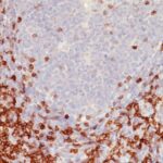 Formalin-fixed, paraffin-embedded human Tonsil stained with CD5 Monoclonal Antibody (C5/473)