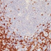Formalin-fixed, paraffin-embedded human Tonsil stained with CD5 Monoclonal Antibody (C5/473)