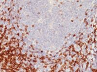 Formalin-fixed, paraffin-embedded human Tonsil stained with CD5 Monoclonal Antibody (C5/473)