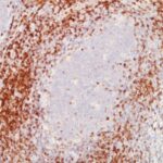 Formalin-fixed, paraffin-embedded human Tonsil stained with CD5 Monoclonal Antibody (C5/473 + CD5/54/F6)