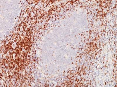 Formalin-fixed, paraffin-embedded human Tonsil stained with CD5 Monoclonal Antibody (C5/473 + CD5/54/F6)