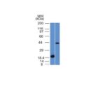 Western Blot Analysis (A) Recombinant Protein (B) Human Liver Lysate Using Aurora B Monoclonal Antibody (AURKB/1521).