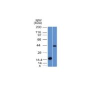 Western Blot Analysis (A) Recombinant Protein (B) Human Liver Lysate Using Aurora B Monoclonal Antibody (AURKB/1521).