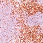 Formalin-fixed, paraffin-embedded human Tonsil stained with CD6 Monoclonal Antibody (3F7B5).