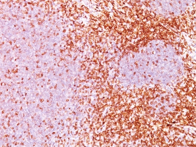 Formalin-fixed, paraffin-embedded human Tonsil stained with CD6 Monoclonal Antibody (3F7B5).