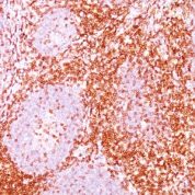 Formalin-fixed, paraffin-embedded human Tonsil stained with CD6 Monoclonal Antibody (C6/372).