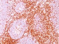 Formalin-fixed, paraffin-embedded human Tonsil stained with CD6 Monoclonal Antibody (C6/372).