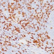 Formalin-fixed, paraffin-embedded human Tonsil stained with CD8a Monoclonal Antibody (SPM548).