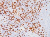 Formalin-fixed, paraffin-embedded human Tonsil stained with CD8a Monoclonal Antibody (SPM548).