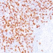 Formalin-fixed, paraffin-embedded human Tonsil stained with CD8 Monoclonal Antibody (C8/144B).