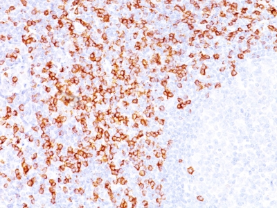 Formalin-fixed, paraffin-embedded human Tonsil stained with CD8 Monoclonal Antibody (C8/144B).