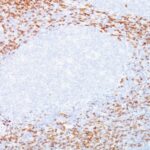 Formalin-fixed, paraffin-embedded human Tonsil stained with CD8 Monoclonal Antibody (C8/468 + C8/144B).