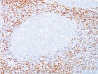 Formalin-fixed, paraffin-embedded human Tonsil stained with CD8 Monoclonal Antibody (C8/468 + C8/144B).