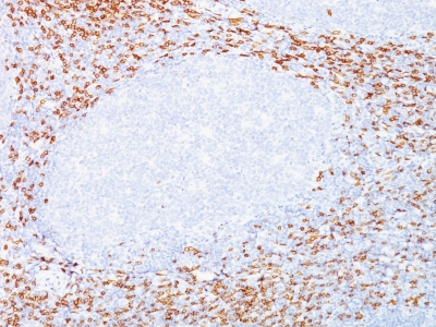 Formalin-fixed, paraffin-embedded human Tonsil stained with CD8 Monoclonal Antibody (C8/468 + C8/144B).