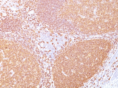 Formalin-fixed, paraffin-embedded human Tonsil stained with CD2 Monoclonal Antibody (IGEL/773)