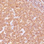 Formalin-fixed, paraffin-embedded human Tonsil stained with CD2 Monoclonal Antibody (SPM618)