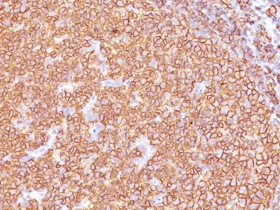Formalin-fixed, paraffin-embedded human Tonsil stained with CD2 Monoclonal Antibody (SPM618)