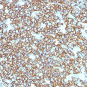 Formalin-fixed, paraffin-embedded human Tonsil stained with CD2 Recombinant Mouse Monoclonal Antibody (rIGEL/773).