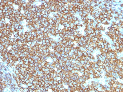 Formalin-fixed, paraffin-embedded human Tonsil stained with CD2 Recombinant Mouse Monoclonal Antibody (rIGEL/773).