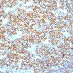 Formalin-fixed, paraffin-embedded human Tonsil stained with CD2 Recombinant Rabbit Monoclonal Antibody (IGEL/1497R)