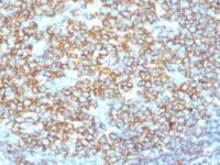 Formalin-fixed, paraffin-embedded human Tonsil stained with CD2 Recombinant Rabbit Monoclonal Antibody (IGEL/1497R)