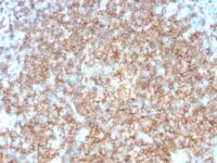 Western Blot Analysis of Raji and Ramos Cell Lysates using CD22 Monoclonal Antibody (BLCAM/1795).