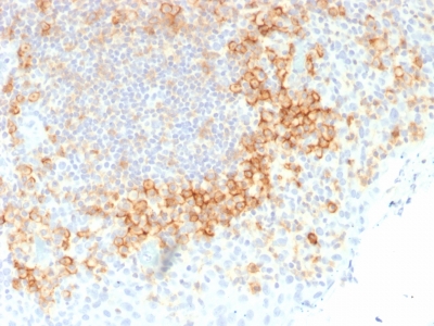 Formalin-fixed, paraffin-embedded human Tonsil stained with CD27 Monoclonal Antibody (LPFS2/1611).