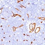 Formalin-fixed, paraffin-embedded human Tonsil stained with CD34 Monoclonal Antibody (SPM123)