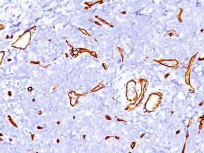 Formalin-fixed, paraffin-embedded human Tonsil stained with CD34 Monoclonal Antibody (SPM123)