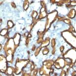 Formalin-fixed, paraffin-embedded human Tonsil stained with CD34 Monoclonal Antibody (HPCA1/763)