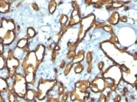 Formalin-fixed, paraffin-embedded human Tonsil stained with CD34 Monoclonal Antibody (HPCA1/763)