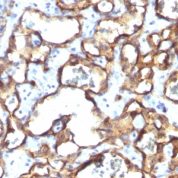 Formalin-fixed, paraffin-embedded human Tonsil stained with CD34 Monoclonal Antibody (HPCA1/1171)