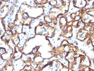 Formalin-fixed, paraffin-embedded human Tonsil stained with CD34 Monoclonal Antibody (HPCA1/1171)