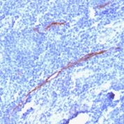 Formalin-fixed, paraffin-embedded human Tonsil stained with CD34 Recombinant Rabbit Monoclonal Antibody (HPCA1/186R)