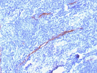 Formalin-fixed, paraffin-embedded human Tonsil stained with CD34 Recombinant Rabbit Monoclonal Antibody (HPCA1/186R)
