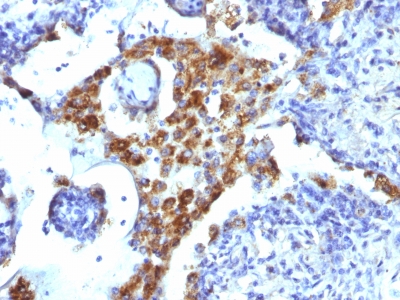 Western Blot of K562 and HEK293 Cell Lysates Using Napsin-A Monoclonal Antibody (NAPSA/1239)
