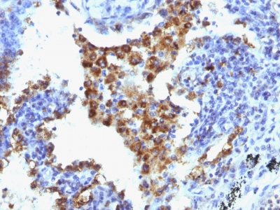 Western Blot of K562, HEK293 andA549 Cell Lysates Using Napsin-A Monoclonal Antibody (NAPSA/1238 + NAPSA/1239)