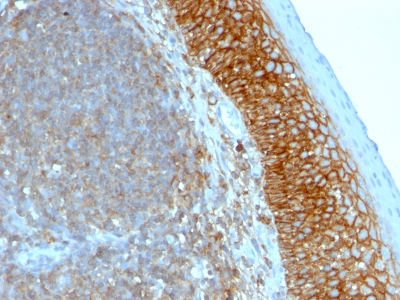 Formalin-fixed, paraffin-embedded human Tonsil stained with CD44 Monoclonal Antibody (SPM544)